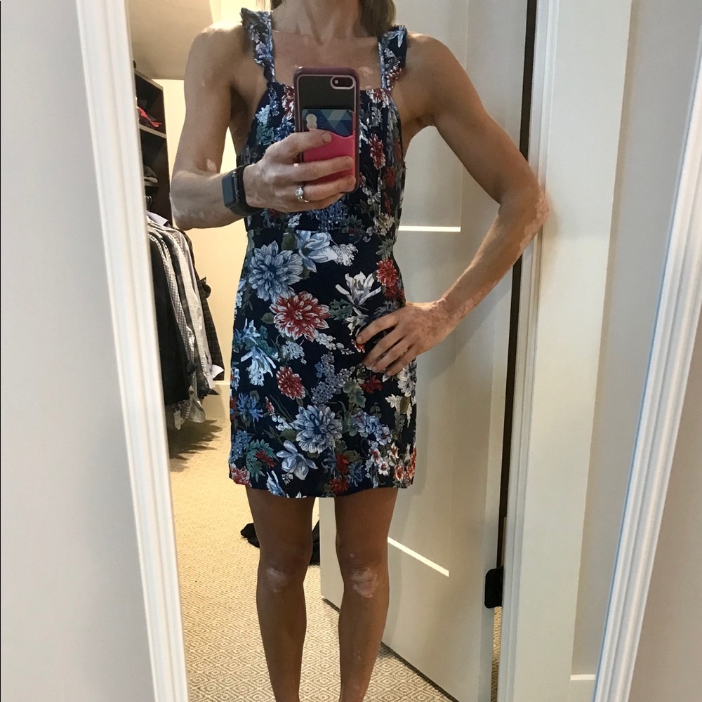 Worn ONCE LF Open back Navy Floral Dress sz XS